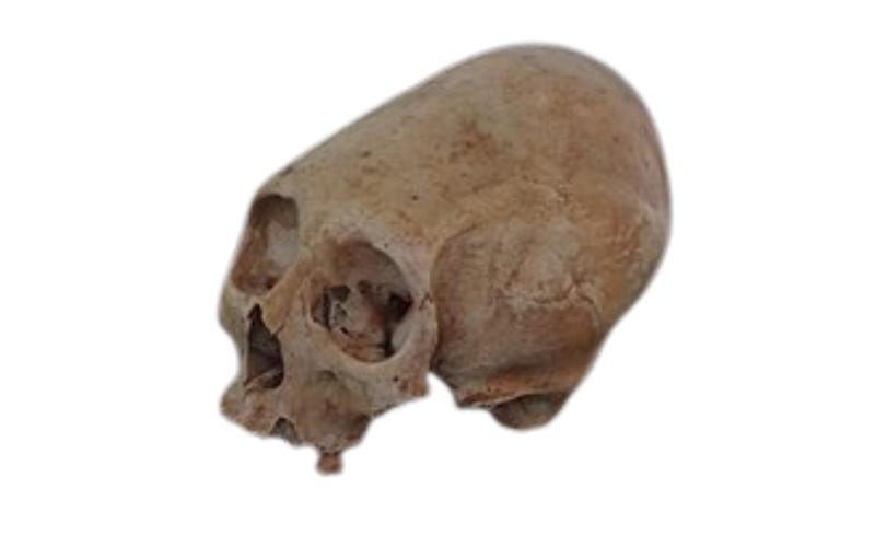 Cráneo Deformado Panche